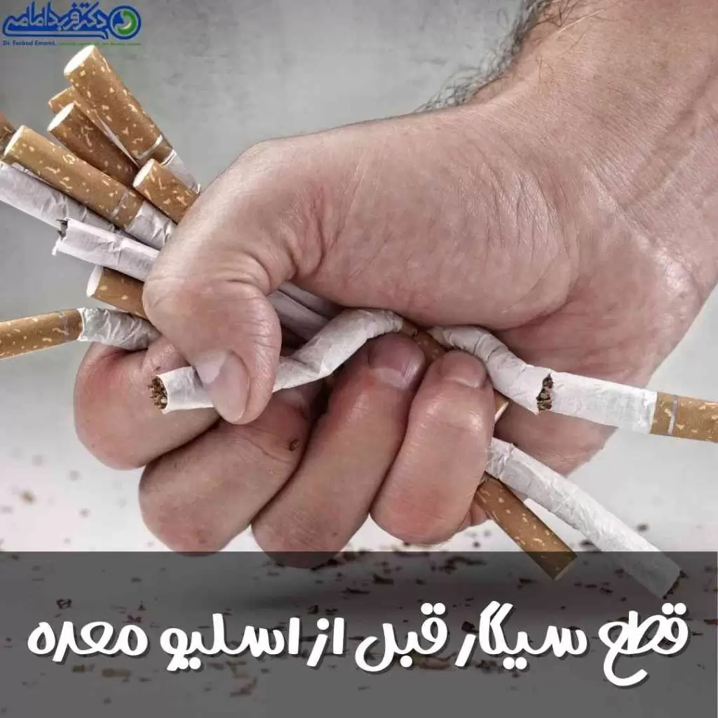 ترک سیگار قبل از عمل اسلیو معده