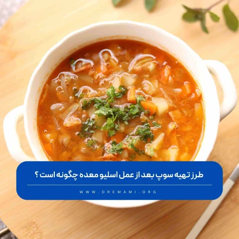 تهیه سوپ بعد از اسلیو معده