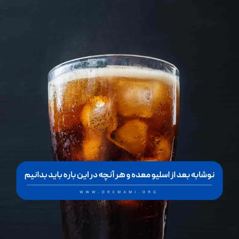 نوشابه بعد از عمل اسلیو معده
