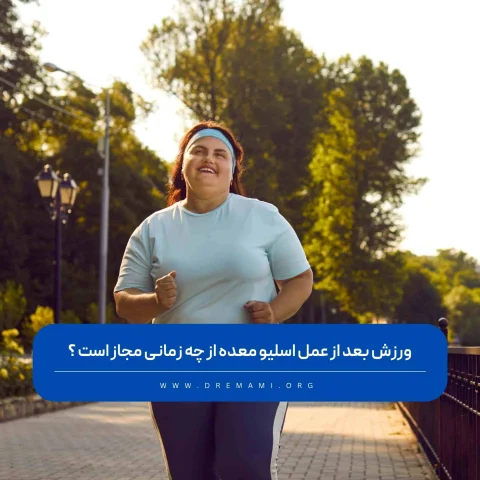 ورزش بعد از اسلیو معده