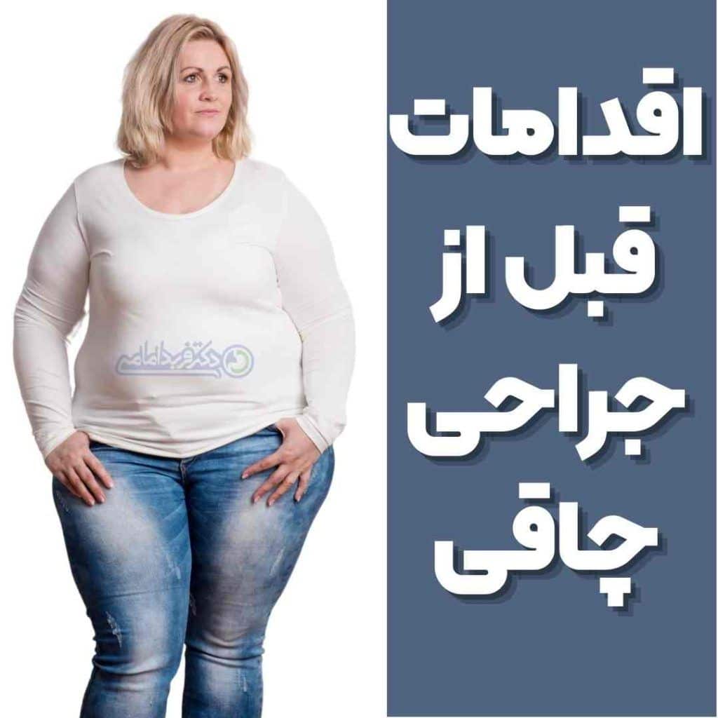 اقدامات قبل از عمل اسلیو معده