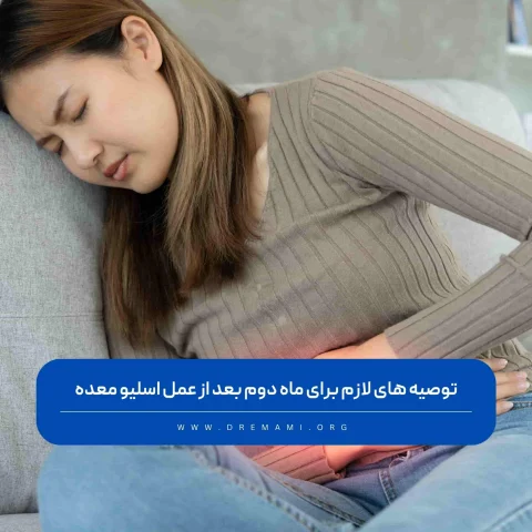 ماه دوم بعد از عمل اسلیو