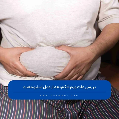 ورم شکم بعد از عمل اسلیو معده