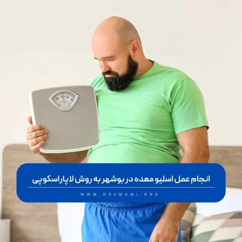 عمل اسلیو معده در بوشهر