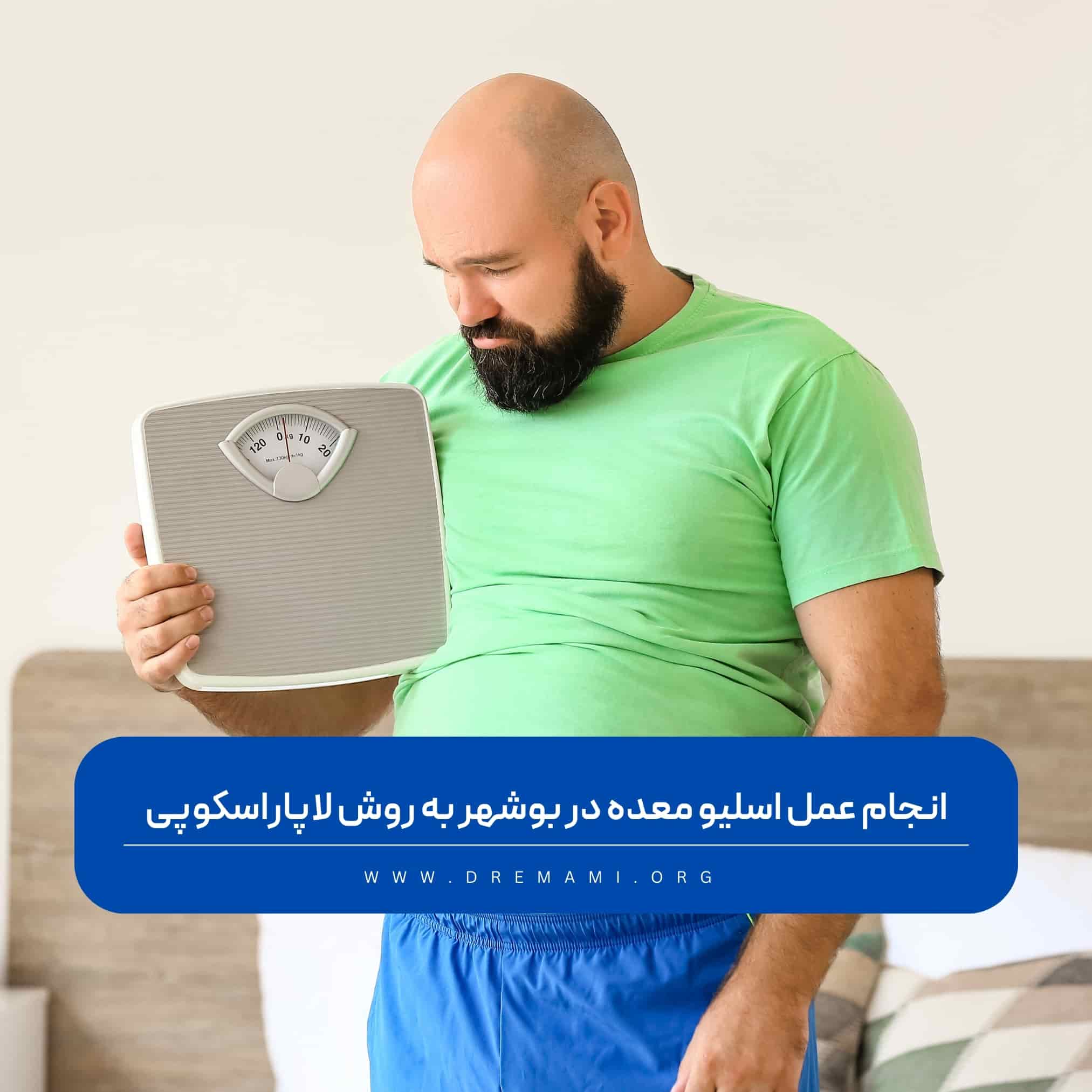 عمل اسلیو معده در بوشهر