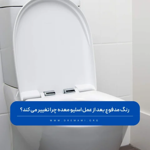 رنگ مدفوع بعد از عمل اسلیو
