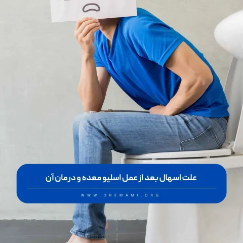 اسهال بعد از عمل اسلیو معده