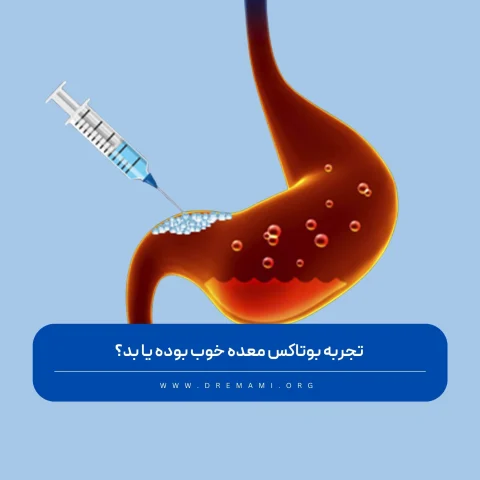 تجربه بوتاکس معده