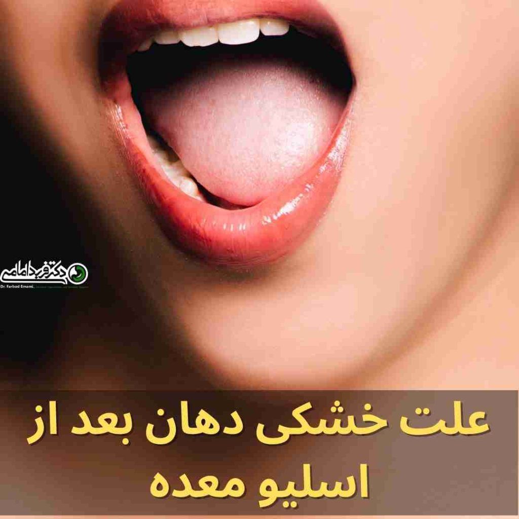 علت خشکی دهان بعد از اسلیو معده