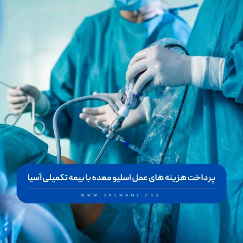 عمل اسلیو معده با بیمه تکمیلی آسیا
