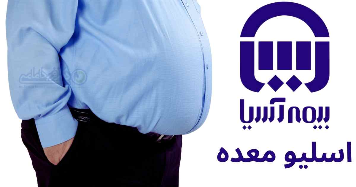 عمل اسلیو معده با بیمه تکمیلی آسیا