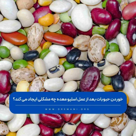 خوردن حبوبات بعد از عمل اسلیو معده