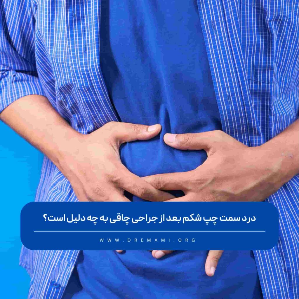 درد سمت چپ شکم بعد از عمل چاقی