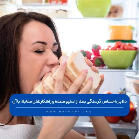 گرسنگی بعد از اسلیو معده