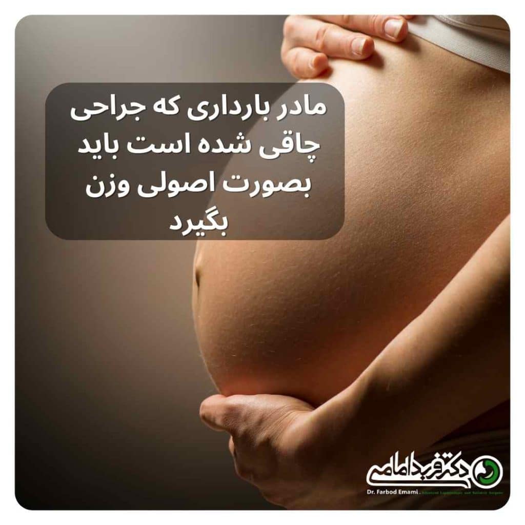 میزان مناسب افزایش وزن در بارداری بعد از جراحی چاقی