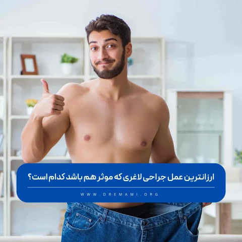 ارزانترین عمل جراحی لاغری