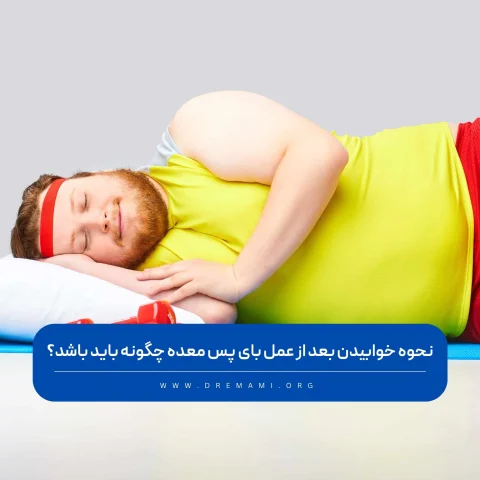 نحوه خوابیدن بعد از عمل بای پس معده