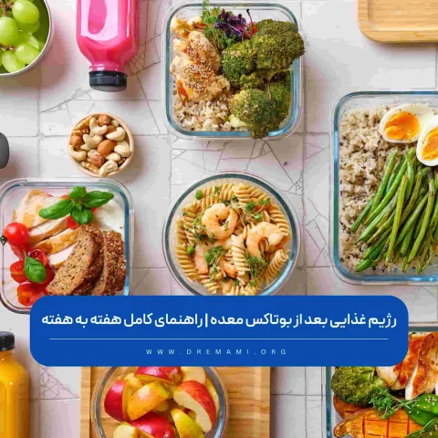 رژیم غذایی بعد از بوتاکس معده