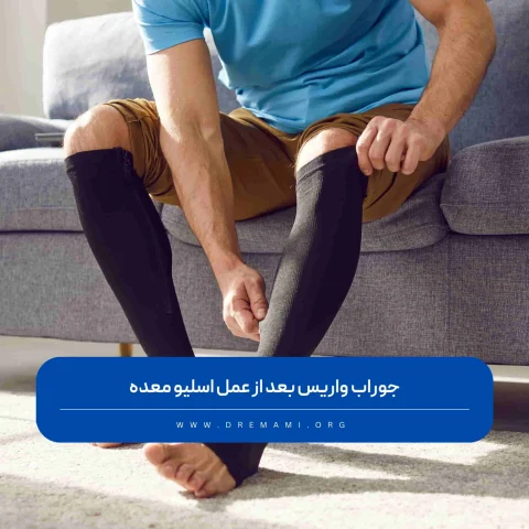 جوراب واریس بعد از عمل اسلیو معده