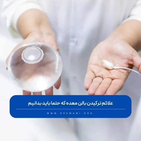 علائم ترکیدن بالن معده