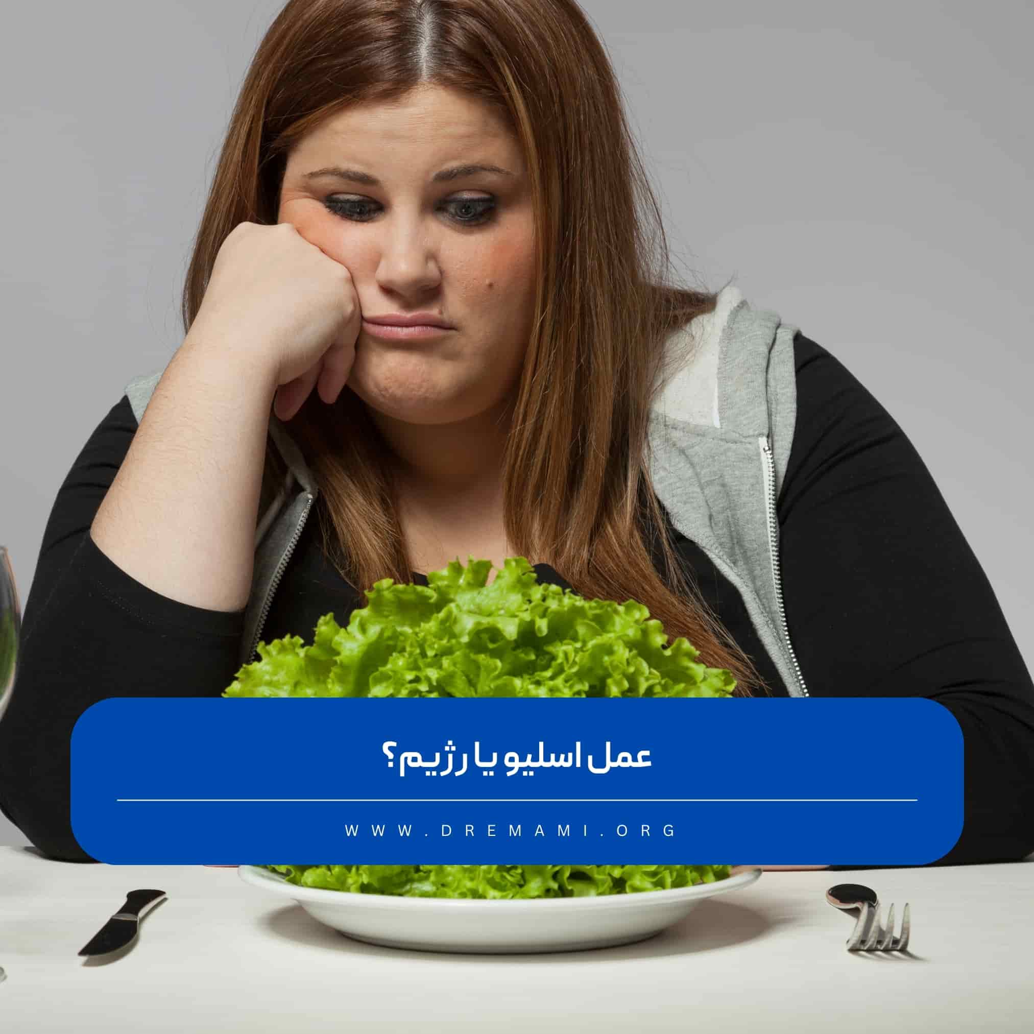 عمل اسلیو یا رژیم