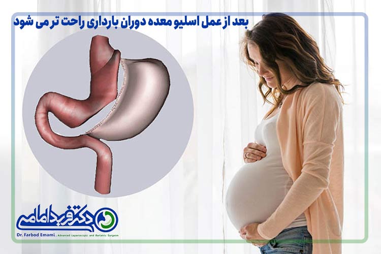 بعد از عمل اسلیو معده دوران بارداری راحت تر می شود؟