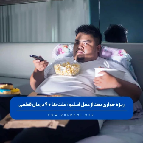 ریزه خواری بعد از اسلیو معده