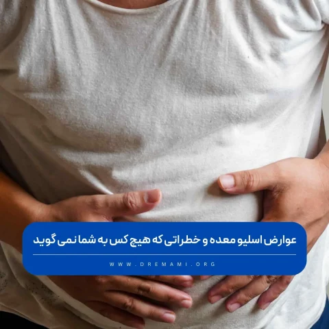 عوارض اسلیو معده