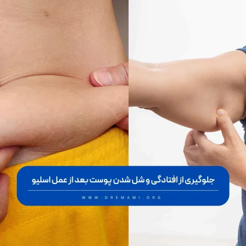 افتادگی پوست بعد از عمل اسلیو