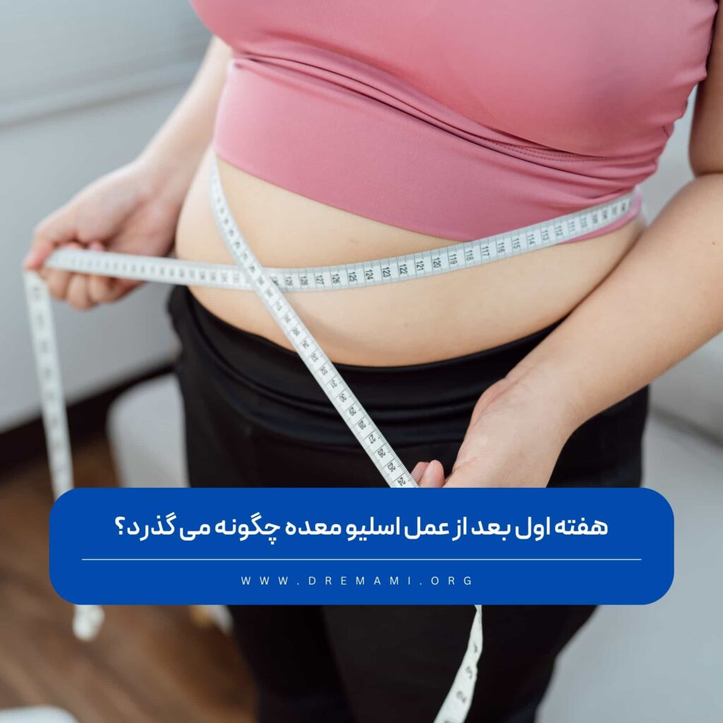 هفته اول بعد از اسلیو معده