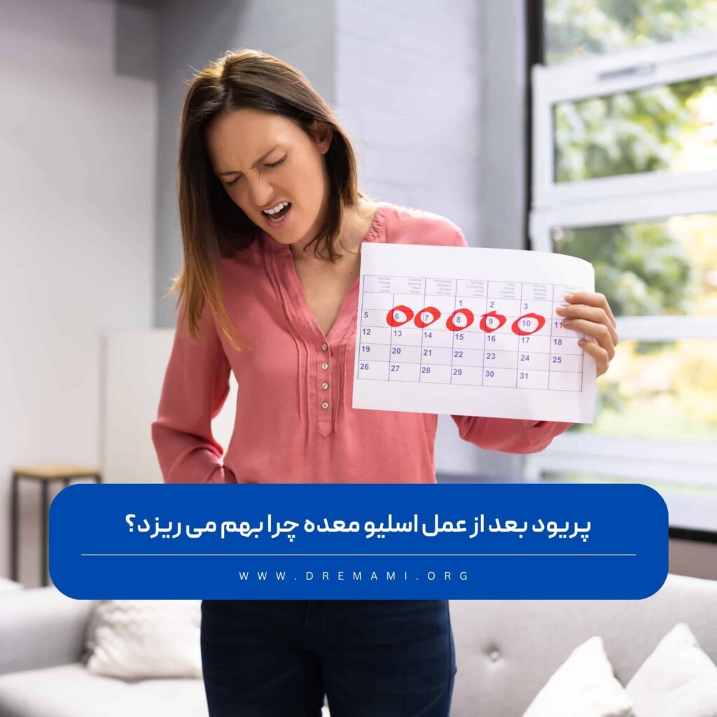 پریود بعد از اسلیو معده