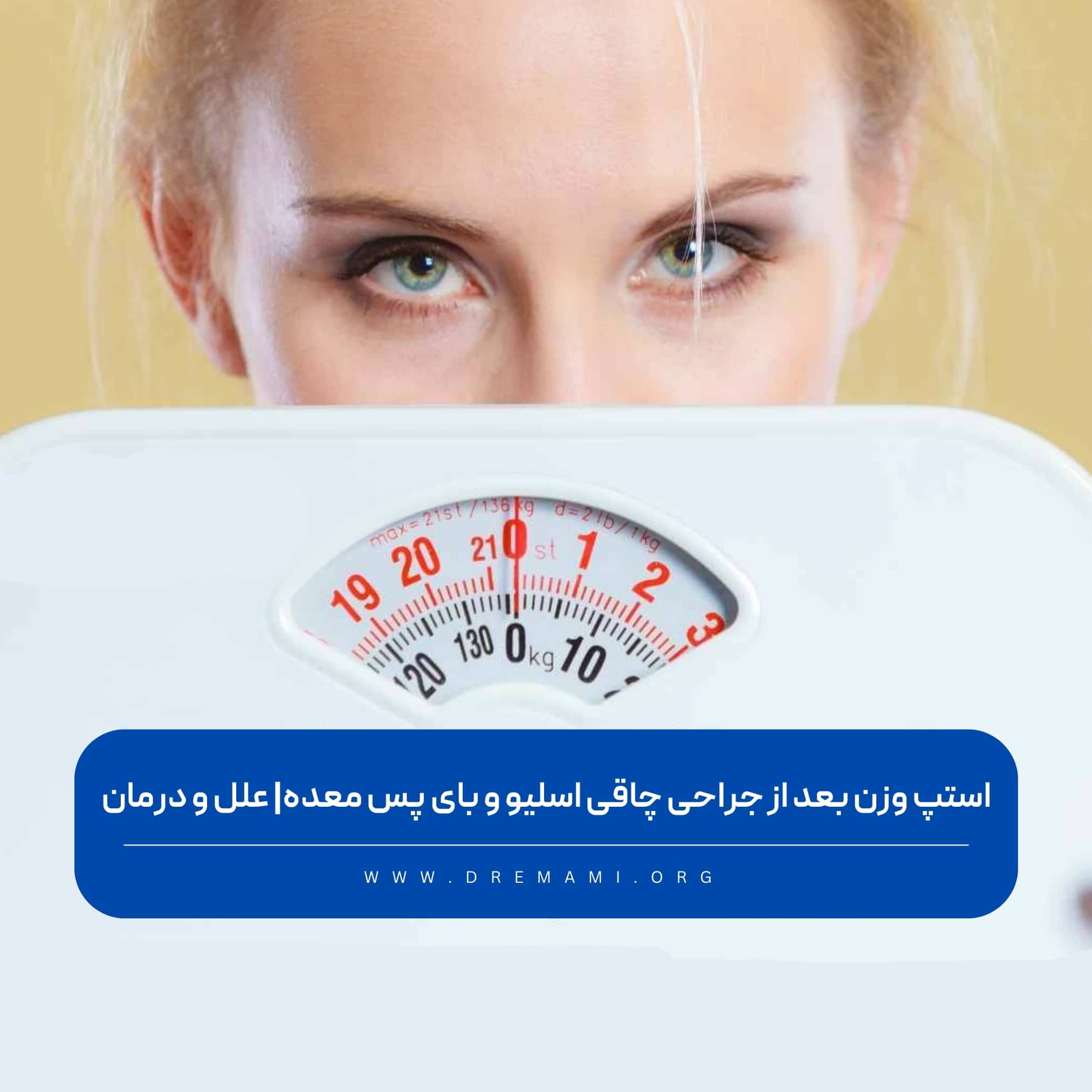 استپ وزن بعد از جراحی چاقی