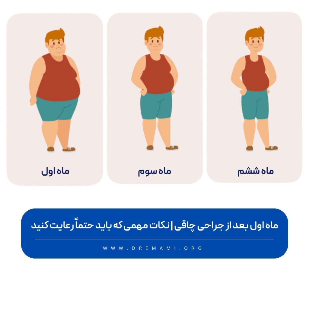 ماه اول بعد از جراحی چاقی