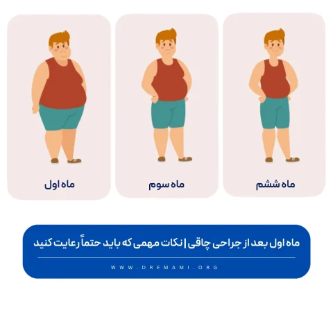 ماه اول بعد از جراحی چاقی