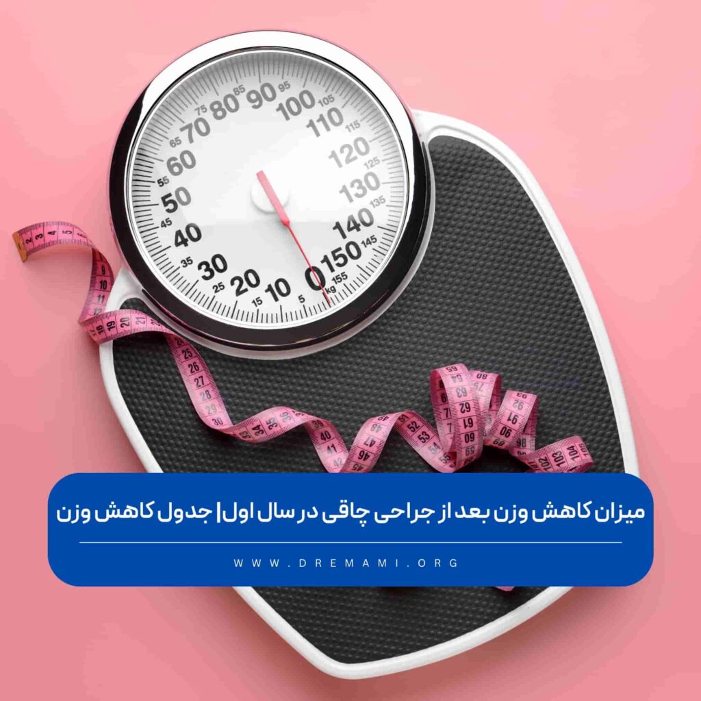 میزان کاهش وزن بعد از اسلیو معده و بای پس