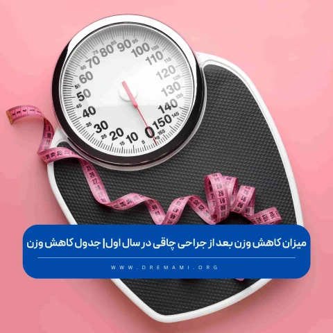 میزان کاهش وزن بعد از اسلیو معده و بای پس