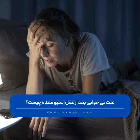 بی خوابی بعد از عمل اسلیو معده