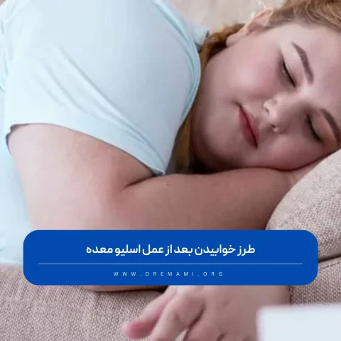 نحوه خوابیدن بعد از عمل اسلیو معده