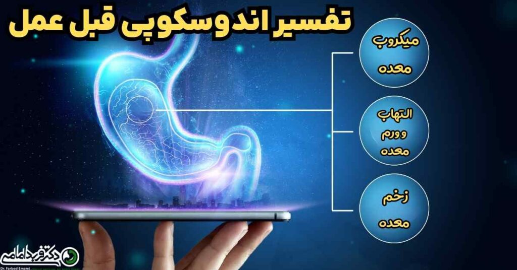 تفسیر پاسخ اندوسکوپی قبل از عمل اسلیو