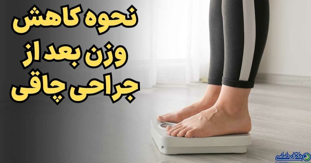 میزان کاهش وزن بعد از اسلیو معده و بای پس