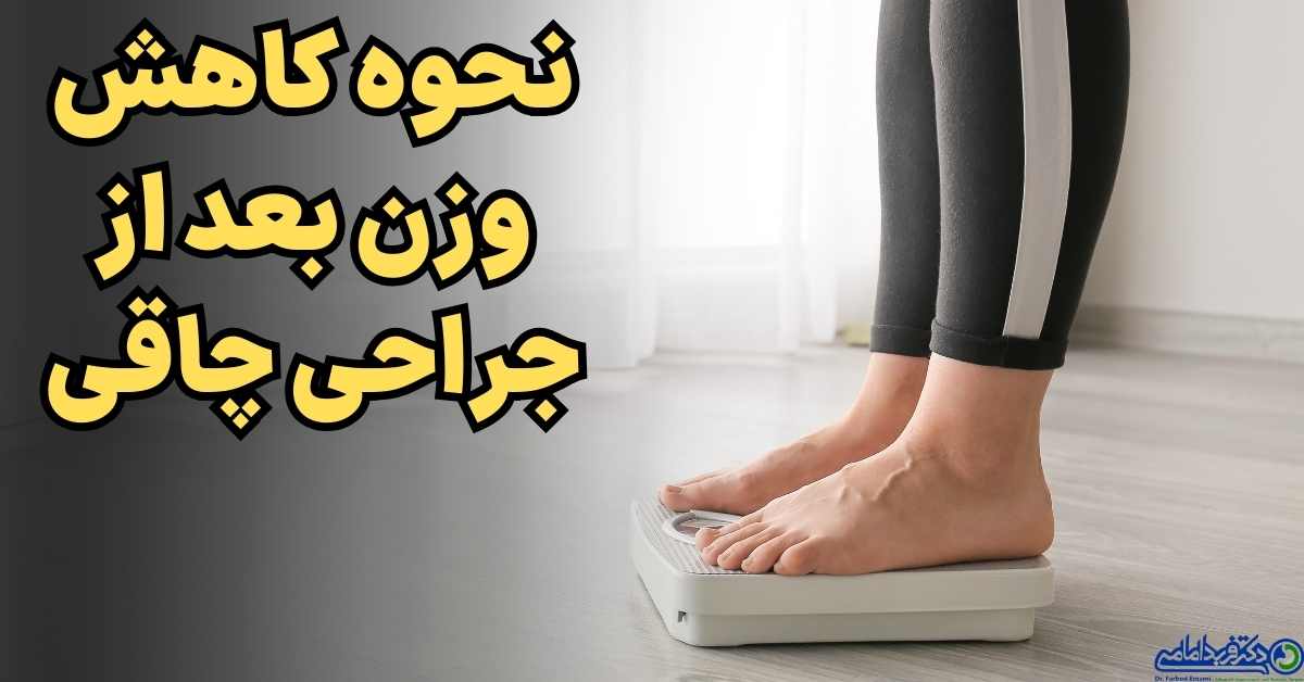 میزان کاهش وزن بعد از اسلیو معده و بای پس