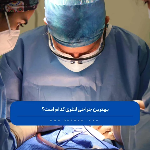 بهترین جراحی لاغری کدام است؟