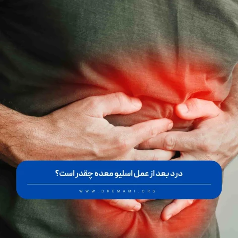 درد بعد از عمل اسليو معده چقدر است؟