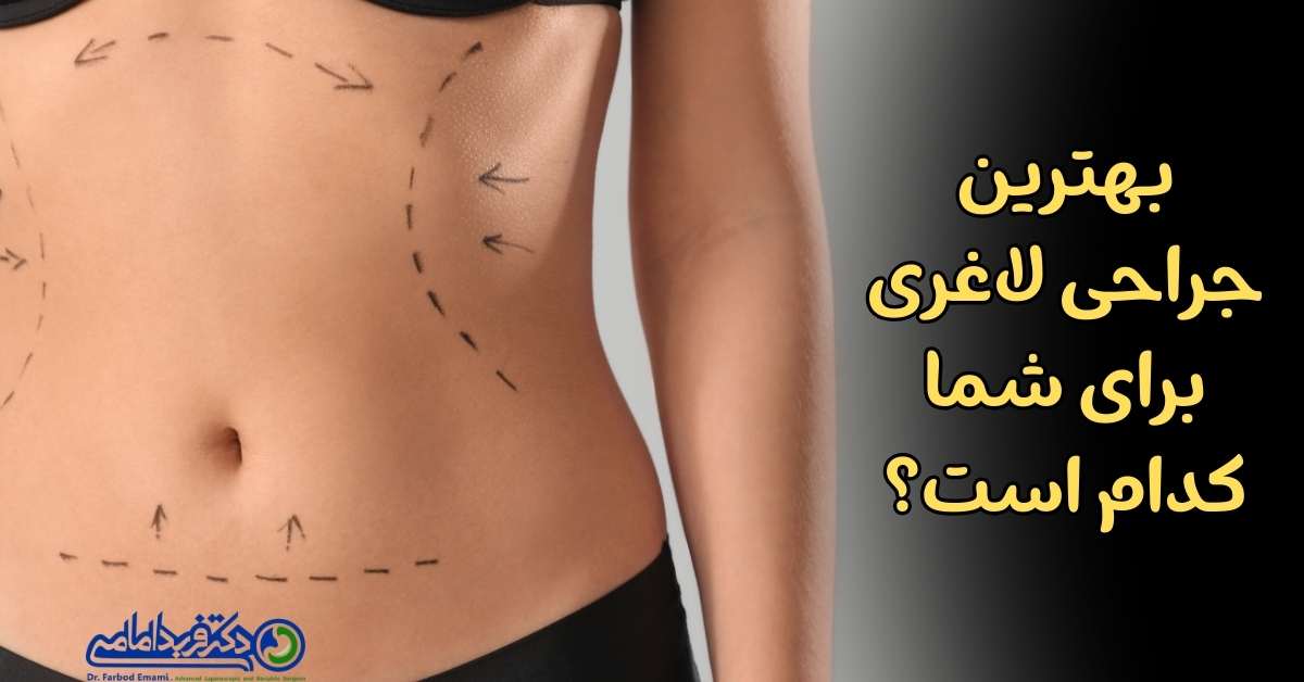 بهترین جراحی لاغری