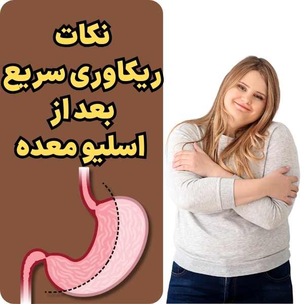 نقاهت بعد از اسلیو معده