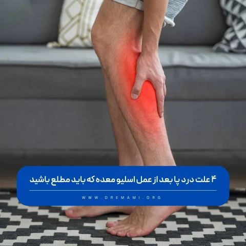 گرفتگی پا بعد از عمل اسلیو معده