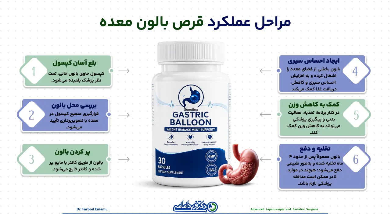 قرص بالون معده