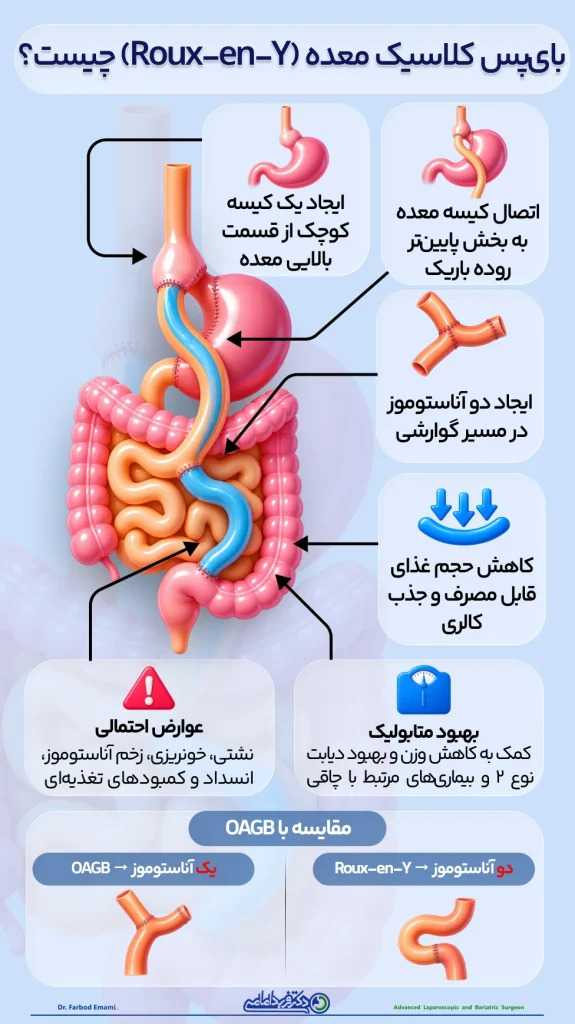 اینفوگرافی بای‌پس کلاسیک معده (Roux-en-Y) چیست؟