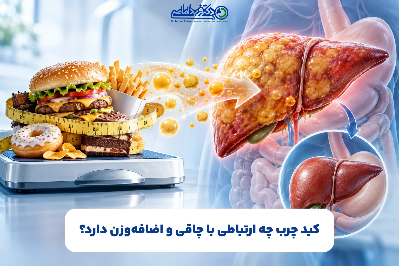 کبد چرب چه ارتباطی با چاقی و اضافه‌وزن دارد؟