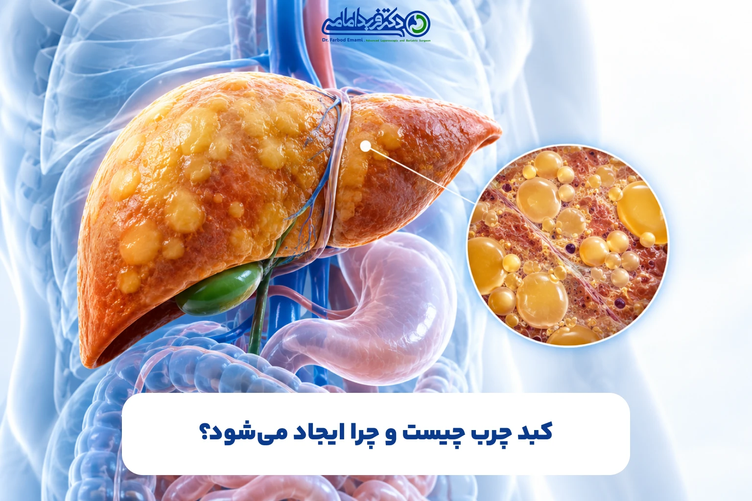 کبد چرب چیست و چرا ایجاد می‌شود؟